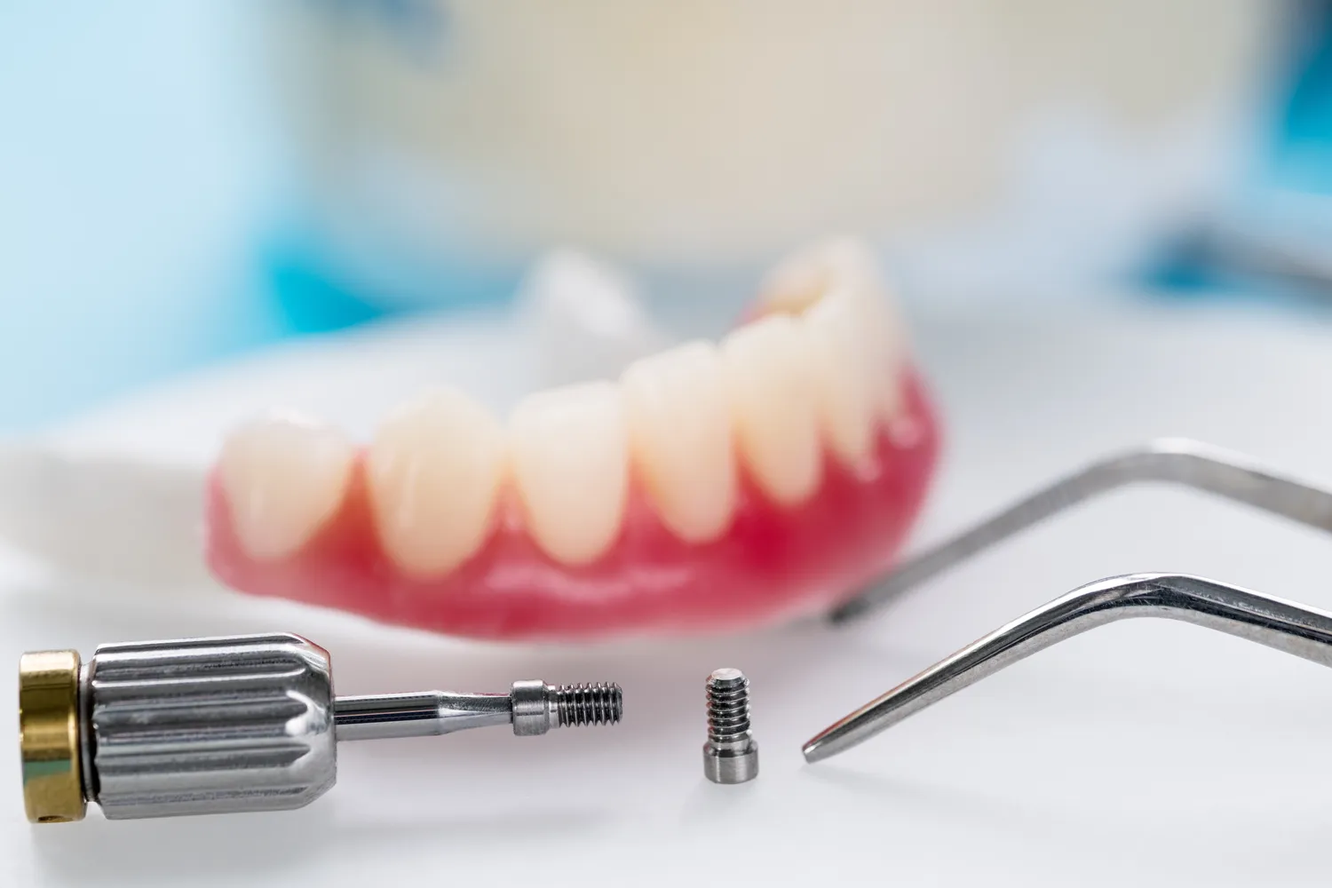 Implanty dentystyczne Warszawa